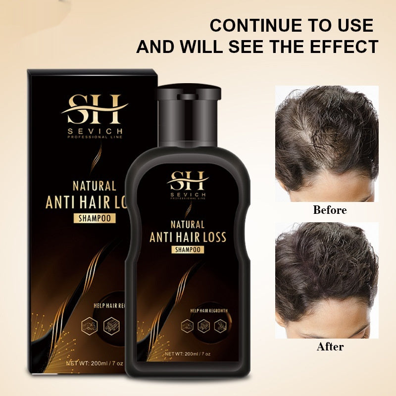 SEVICH Ginger Anti-Hair Loss & Anti-Dandruff Shampoo – Dense Hair Care
