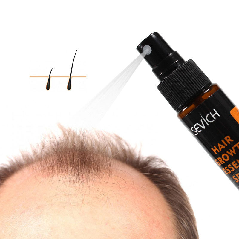 Spray de esencia para el crecimiento del cabello con jengibre de Sevich: loción para el tratamiento del cuero cabelludo y la caída del cabello