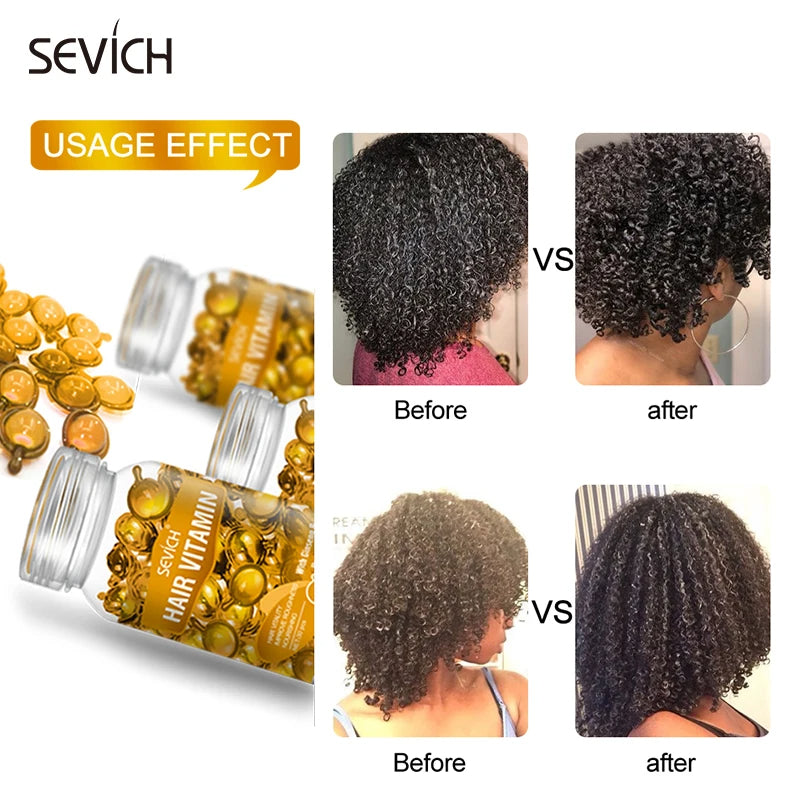 Sevich Hair Vitamin Jojoba + Moroccan Oil for Moisturizing & Smooth Hair Care Capsules