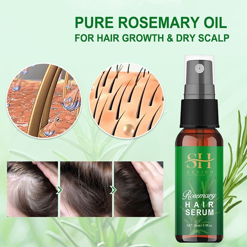 Sevich Rosemary Hair Growth Serum – Essential Oil Spray for Hair Repair and Revitalization